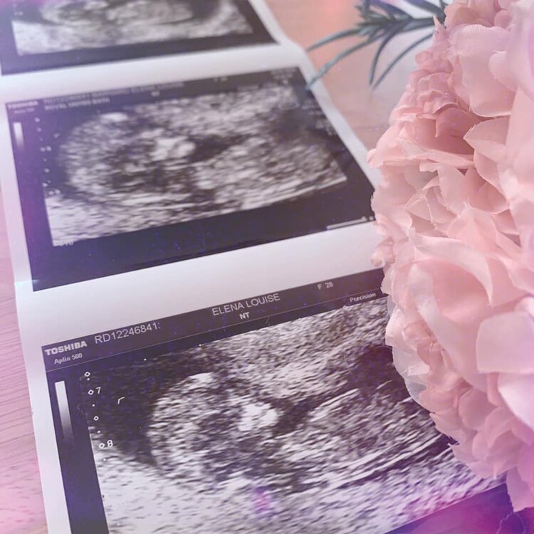 decorative photo of elena and alex's ultrasound scan of niko